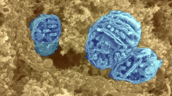 Mitochondria in cytoplasm.jpg