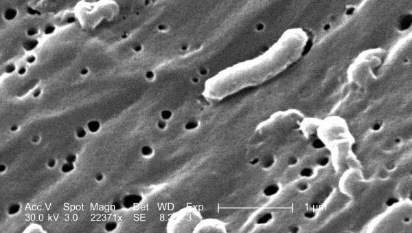 Scanning electron micrograph of Vibrio cholerae bacterium.jpg